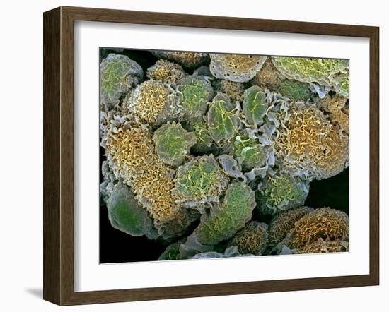 Breast Cancer Cells, SEM-Steve Gschmeissner-Framed Photographic Print