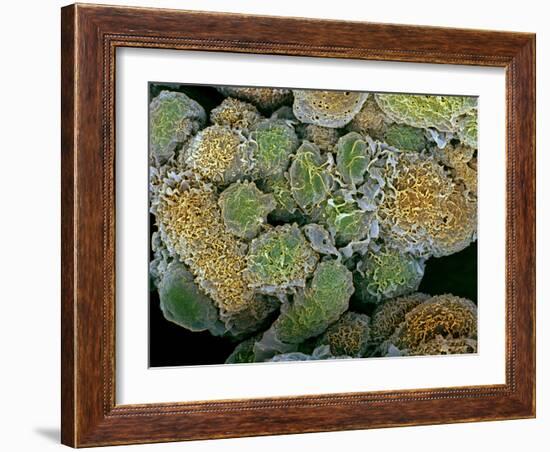 Breast Cancer Cells, SEM-Steve Gschmeissner-Framed Photographic Print