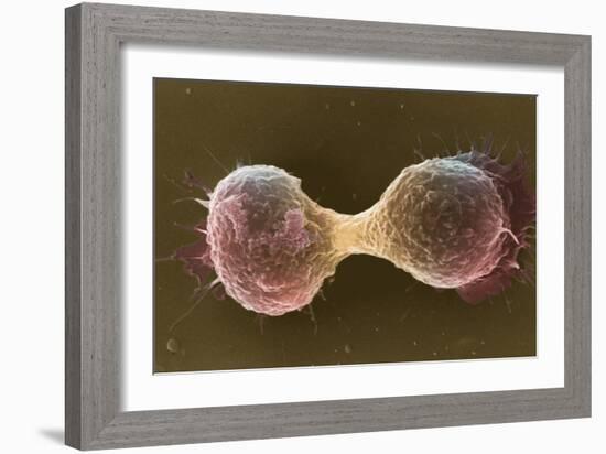 Breast Cancer Cells, SEM-Steve Gschmeissner-Framed Photographic Print
