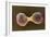 Breast Cancer Cells, SEM-Steve Gschmeissner-Framed Photographic Print