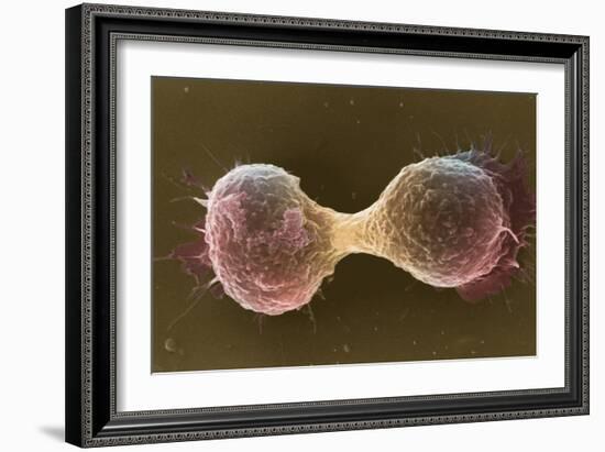 Breast Cancer Cells, SEM-Steve Gschmeissner-Framed Photographic Print