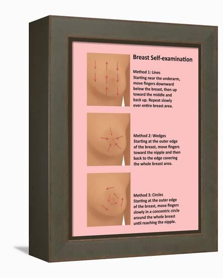 Breast Self Examination-Gwen Shockey-Framed Premier Image Canvas