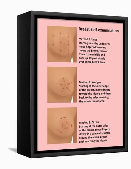 Breast Self Examination-Gwen Shockey-Framed Premier Image Canvas
