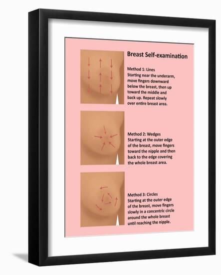 Breast Self Examination-Gwen Shockey-Framed Giclee Print