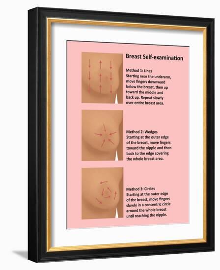 Breast Self Examination-Gwen Shockey-Framed Giclee Print