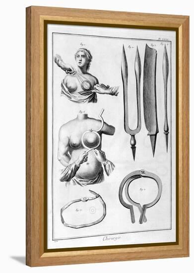 Breast Surgery, 1751-1777-Denis Diderot-Framed Premier Image Canvas