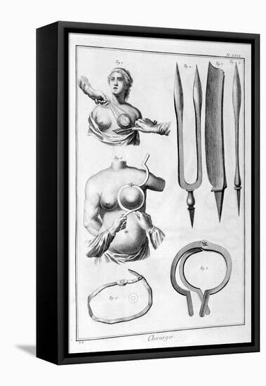 Breast Surgery, 1751-1777-Denis Diderot-Framed Premier Image Canvas