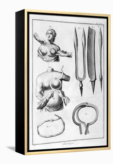 Breast Surgery, 1751-1777-Denis Diderot-Framed Premier Image Canvas