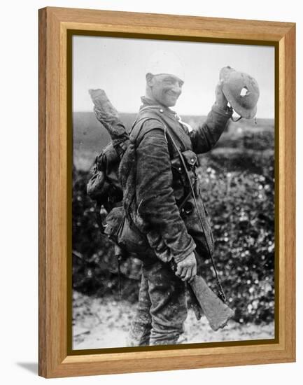 British Soldier with Bandaged Head Shows the Steel Helmet That Saved His Li-English Photographer-Framed Premier Image Canvas