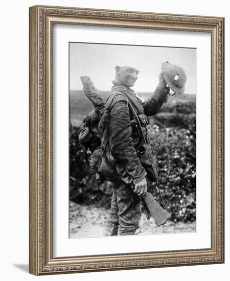 British Soldier with Bandaged Head Shows the Steel Helmet That Saved His Li-English Photographer-Framed Photographic Print