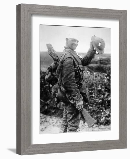 British Soldier with Bandaged Head Shows the Steel Helmet That Saved His Li-English Photographer-Framed Photographic Print