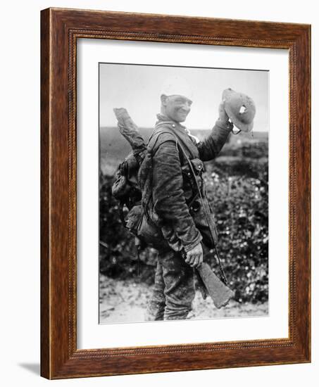British Soldier with Bandaged Head Shows the Steel Helmet That Saved His Li-English Photographer-Framed Photographic Print