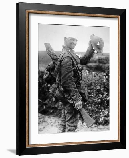 British Soldier with Bandaged Head Shows the Steel Helmet That Saved His Li-English Photographer-Framed Photographic Print