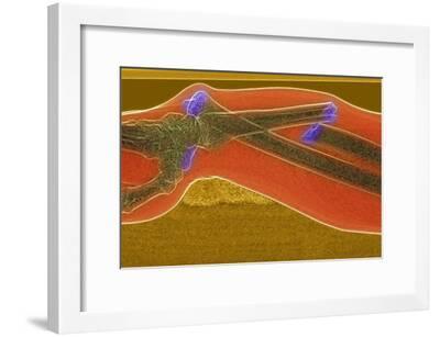 Broken Arm And Dislocated Wrist Photographic Print Du Cane Medical Art Com