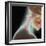 Broken Neck-Science Photo Library-Framed Premium Photographic Print