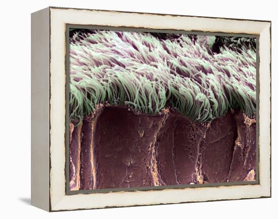 Bronchial Cilia, SEM-Steve Gschmeissner-Framed Premier Image Canvas