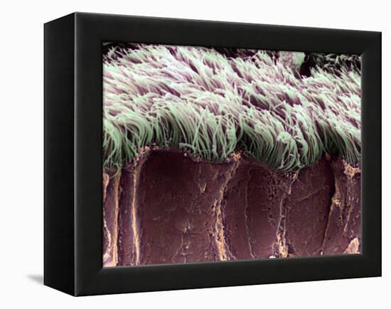 Bronchial Cilia, SEM-Steve Gschmeissner-Framed Premier Image Canvas