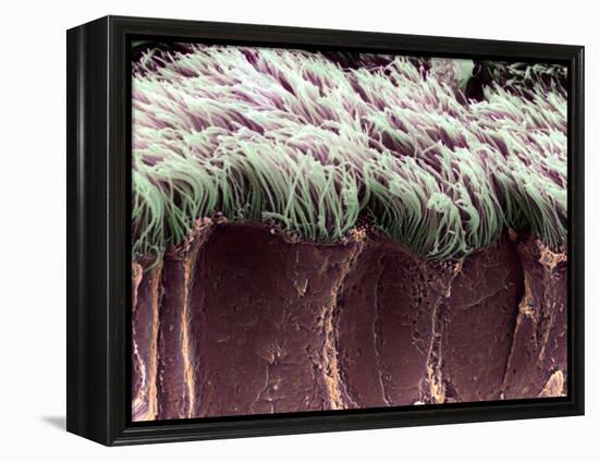 Bronchial Cilia, SEM-Steve Gschmeissner-Framed Premier Image Canvas