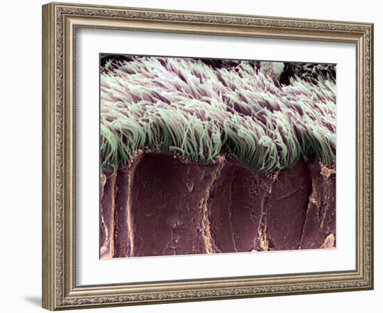 Bronchial Cilia, SEM-Steve Gschmeissner-Framed Photographic Print