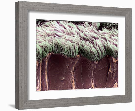 Bronchial Cilia, SEM-Steve Gschmeissner-Framed Photographic Print