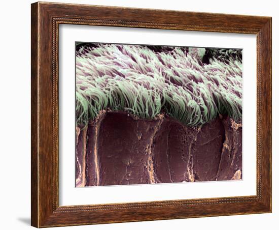 Bronchial Cilia, SEM-Steve Gschmeissner-Framed Photographic Print