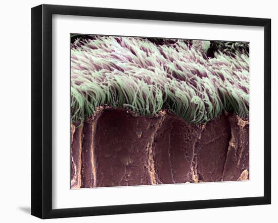 Bronchial Cilia, SEM-Steve Gschmeissner-Framed Photographic Print