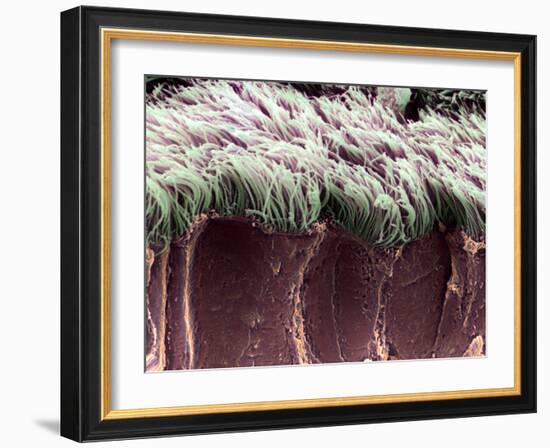 Bronchial Cilia, SEM-Steve Gschmeissner-Framed Photographic Print