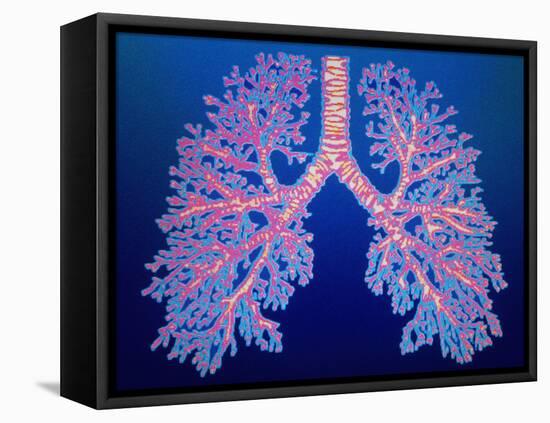 Bronchial Tree of Lungs-PASIEKA-Framed Premier Image Canvas