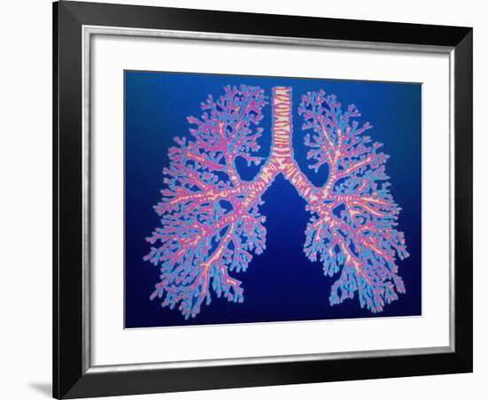 Bronchial Tree of Lungs-PASIEKA-Framed Photographic Print