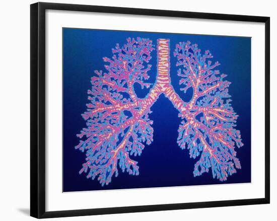 Bronchial Tree of Lungs-PASIEKA-Framed Photographic Print