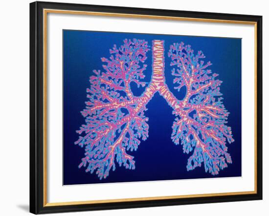 Bronchial Tree of Lungs-PASIEKA-Framed Photographic Print