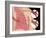 Bronchitis-Monica Schroeder-Framed Giclee Print