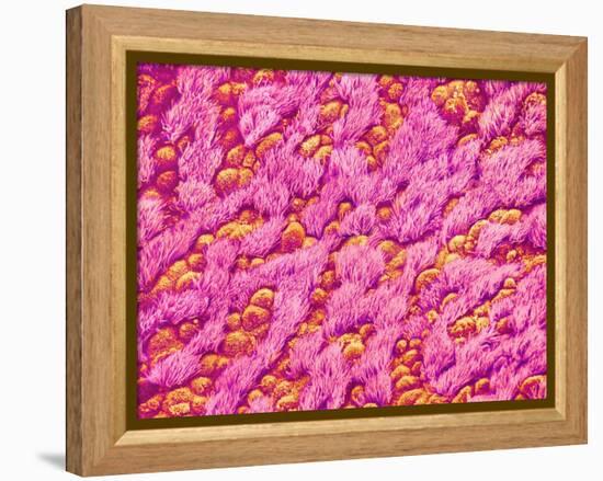 Bronchus of a Rat-Micro Discovery-Framed Premier Image Canvas