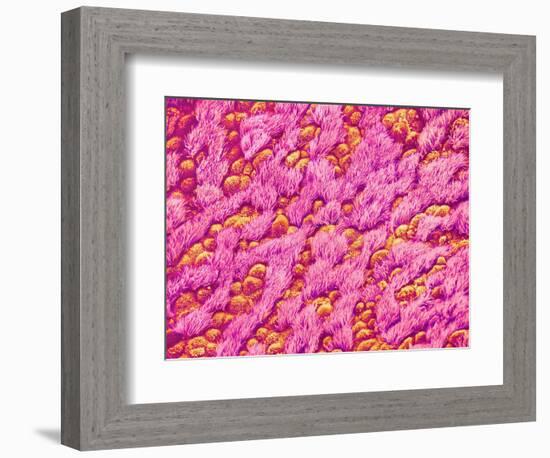 Bronchus of a Rat-Micro Discovery-Framed Photographic Print