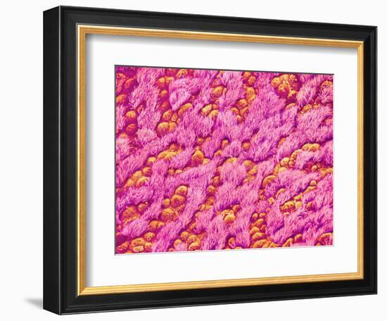 Bronchus of a Rat-Micro Discovery-Framed Photographic Print