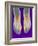 Bunions, X-ray-Science Photo Library-Framed Photographic Print