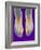 Bunions, X-ray-Science Photo Library-Framed Photographic Print