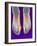 Bunions, X-ray-Science Photo Library-Framed Photographic Print