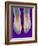 Bunions, X-ray-Science Photo Library-Framed Photographic Print