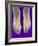 Bunions, X-ray-Science Photo Library-Framed Photographic Print