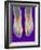 Bunions, X-ray-Science Photo Library-Framed Photographic Print