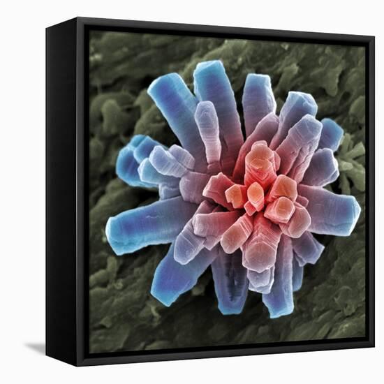 Calcium Phosphate Crystal, SEM-Steve Gschmeissner-Framed Premier Image Canvas