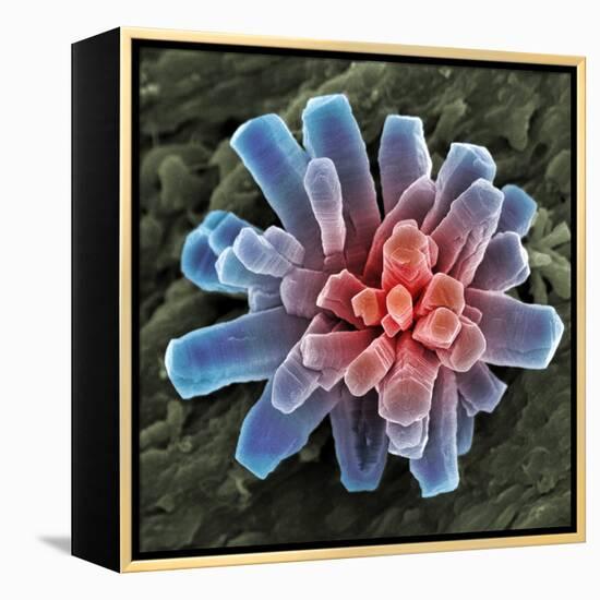 Calcium Phosphate Crystal, SEM-Steve Gschmeissner-Framed Premier Image Canvas