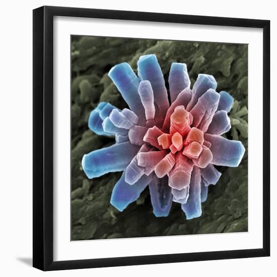 Calcium Phosphate Crystal, SEM-Steve Gschmeissner-Framed Premium Photographic Print