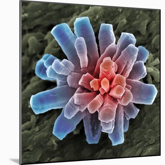 Calcium Phosphate Crystal, SEM-Steve Gschmeissner-Mounted Premium Photographic Print