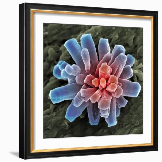 Calcium Phosphate Crystal, SEM-Steve Gschmeissner-Framed Premium Photographic Print