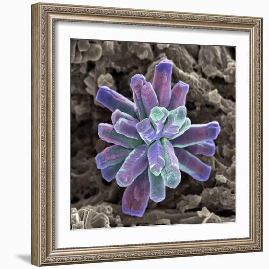 Calcium Phosphate Crystal, SEM-Steve Gschmeissner-Framed Premium Photographic Print