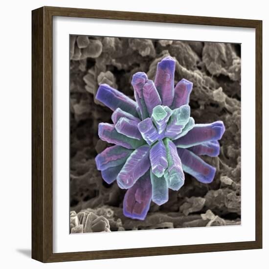 Calcium Phosphate Crystal, SEM-Steve Gschmeissner-Framed Premium Photographic Print