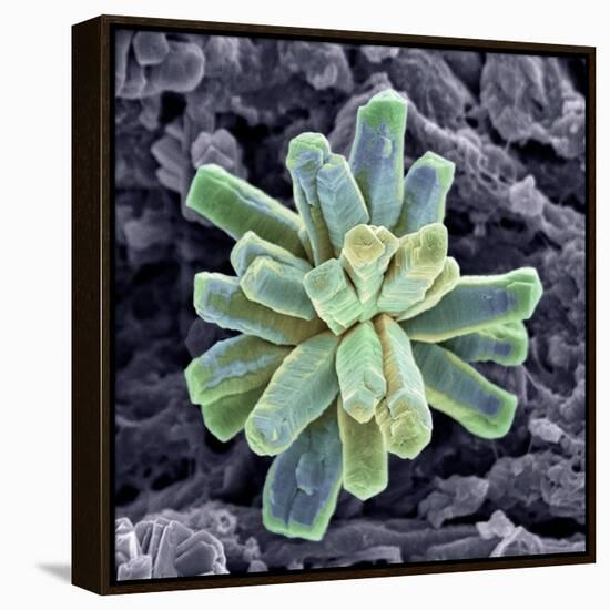 Calcium Phosphate Crystal, SEM-Steve Gschmeissner-Framed Premier Image Canvas