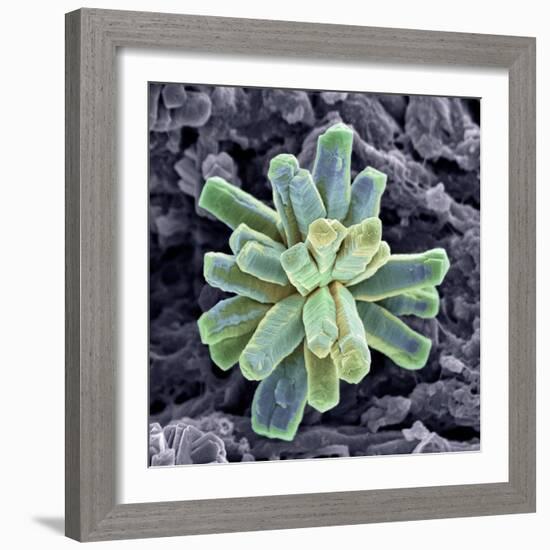 Calcium Phosphate Crystal, SEM-Steve Gschmeissner-Framed Premium Photographic Print